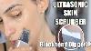 The New Way To Exfoliate Your Face Ultrasonic Skin Scrubber L Blackhead Digger